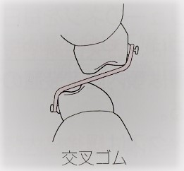 交叉ゴム　顎間ゴム