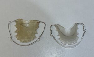 a ラップアラウンドリテーナーの装置の写真