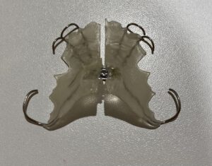 d 床矯正装置の写真